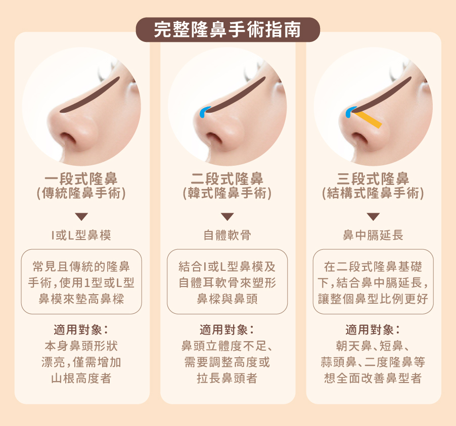 台灣隆鼻手術完整指南 - 鼻整形專業知識