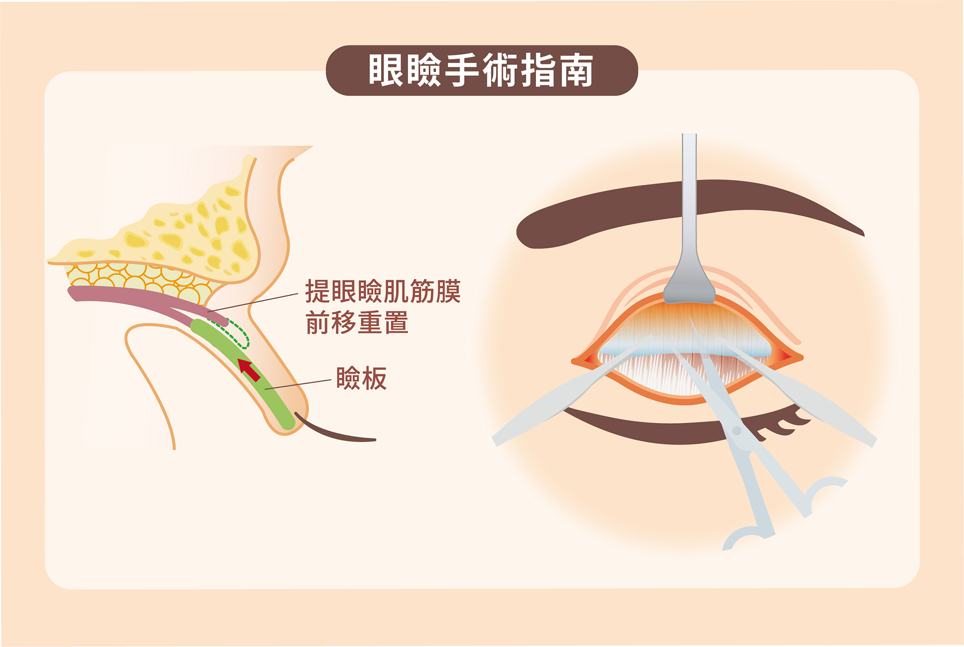眼部整形手術綜合專家建議指南