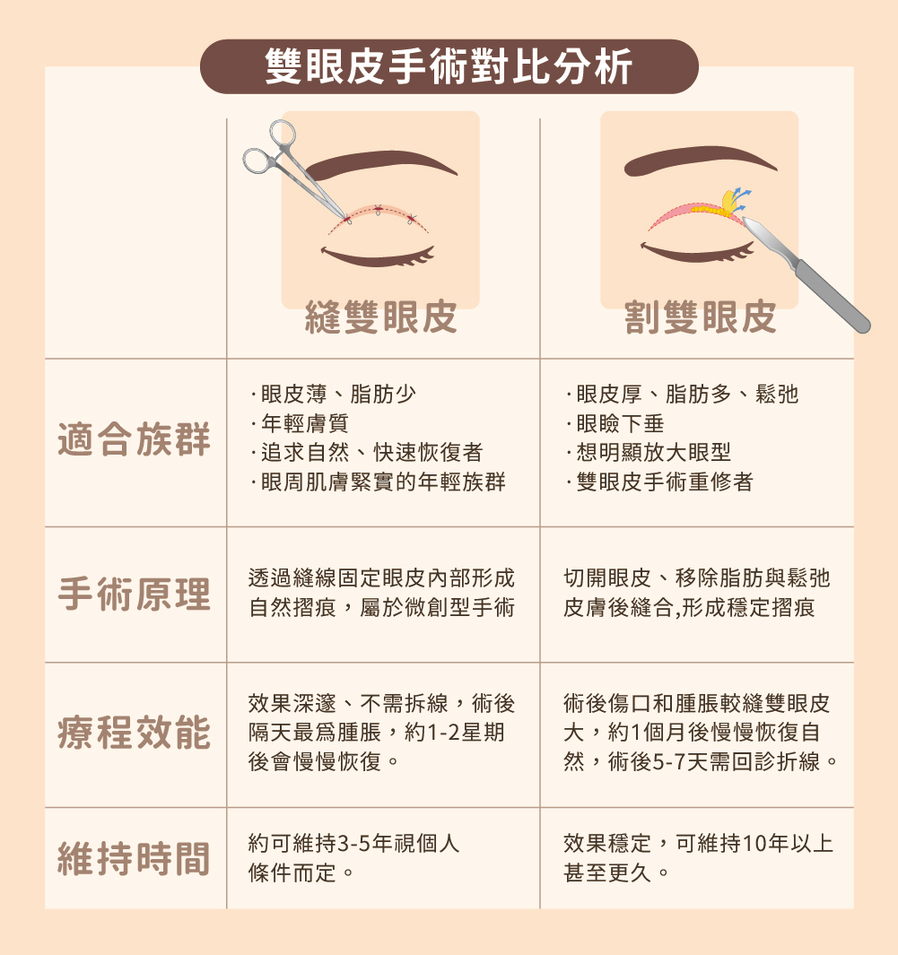 雙眼皮手術方式對比圖 - 縫合式、小切口式、切開式詳細比較