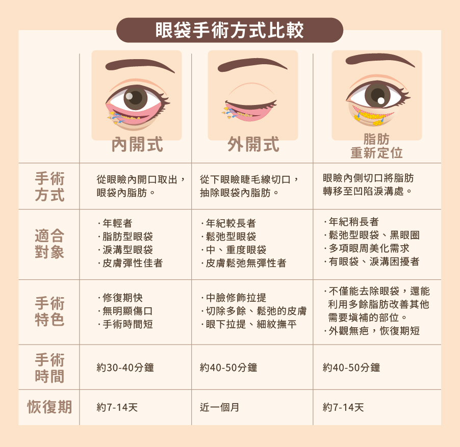 眼袋手術方式對比圖 - 內開式與外開式手術詳細比較示意圖